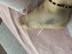 今日は昨日、痛...