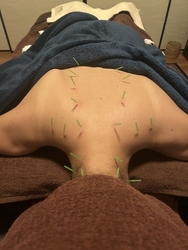 初めての鍼灸院...