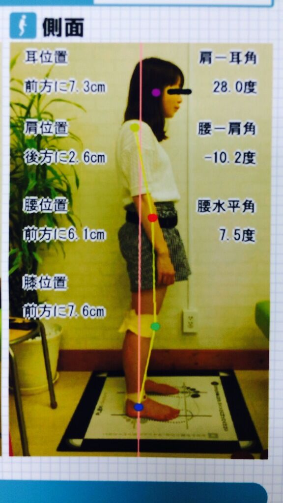 ハニースタイル あずき お客様の声 宇都宮市 骨盤 骨格矯正