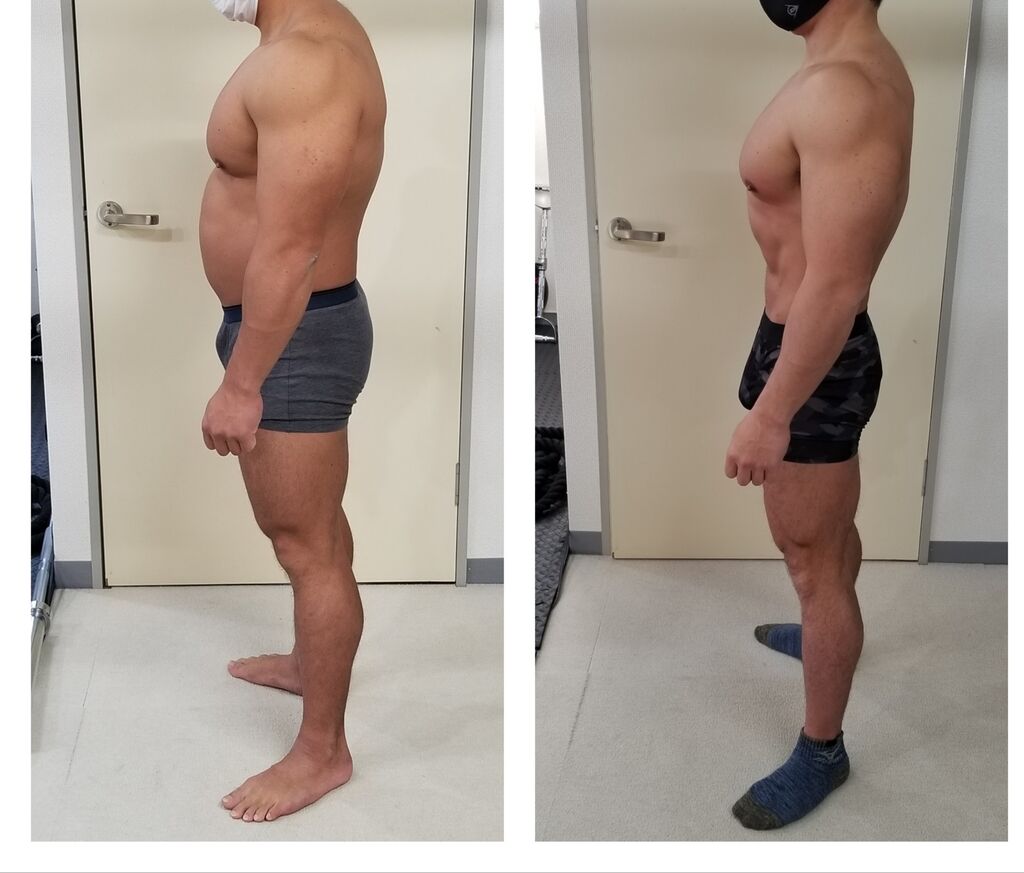 Aki整骨院 サロンharu のニュース 最新情報 宇都宮市 セルライトケア