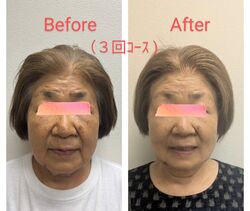 《エイジング》3回効果的！　お肌再生プログラムお試し初回80分