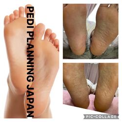 PEDI PLANNING
