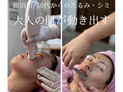 50代〜大人女性の肌改善│2大美容フェイシャルケア