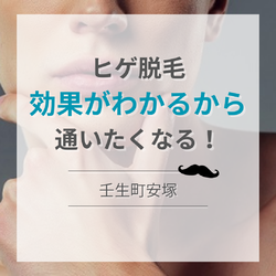 ヒゲ脱毛効果がわかるから通いたくなる
