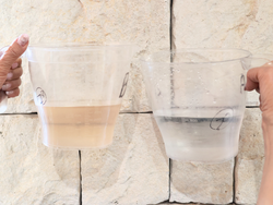 こんなに違う？施術後の排液