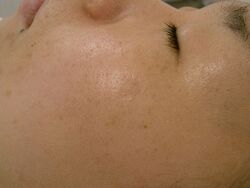 - After -
