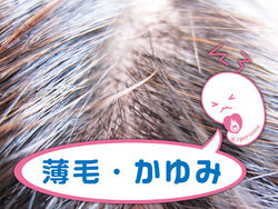 薄毛・かゆみ等のお悩み