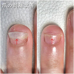 様々な爪のトラブルに対応