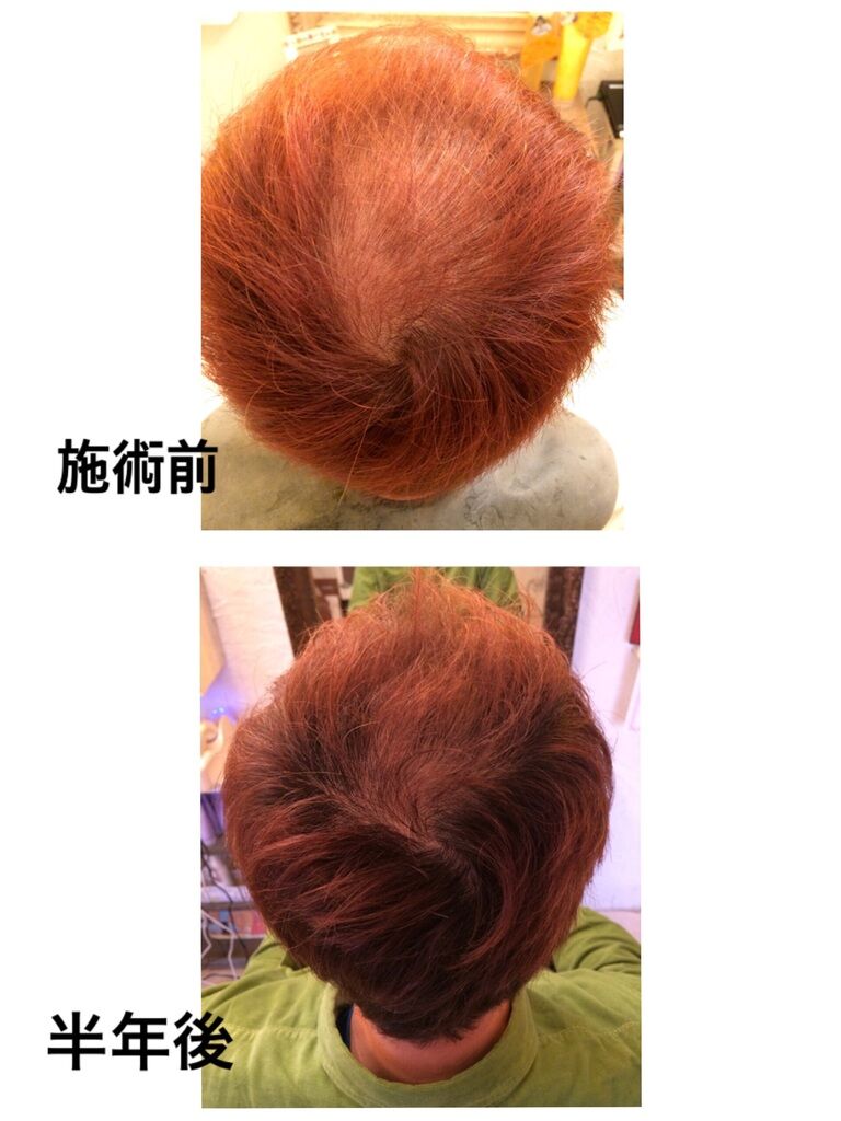 Free Style Wizard 5 宇都宮市の美容室 コスメ 化粧品 ヘアケア フェイシャル 美顔 栃ナビ